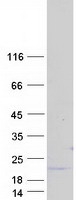 protq96gf1 rnf185 human recombinant protein
