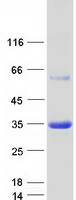 Coomassie blue staining of purified APIP protein