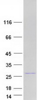 protq96h35 rbm18 human recombinant protein