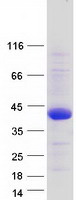 Coomassie blue staining of purified TMEM169 protein