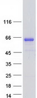 protq96hn2 ahcyl2 human recombinant protein