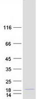protq96hq2 cdkn2aipnl human recombinant protein