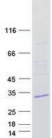 protq96hv5 tmem41a human recombinant protein