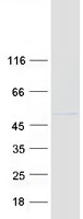 Coomassie blue staining of purified RBM17 protein