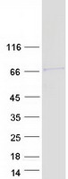 Coomassie blue staining of purified PPP1R16A protein