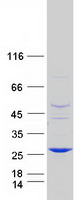 Coomassie blue staining of purified ABHD14B protein