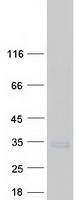 Coomassie blue staining of purified SEC22A protein