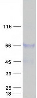 Coomassie blue staining of purified TXNDC15 protein
