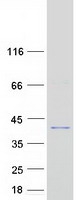 protq96j88 epsti1 human recombinant protein