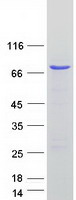 protq96jb5 cdk5rap3 human recombinant protein