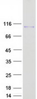 Coomassie blue staining of purified VPS39 protein