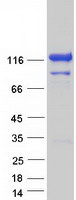 protq96jh7 vcip 135 vcpip1 human recombinant protein