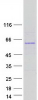 Coomassie blue staining of purified TMX3 protein
