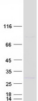 Coomassie blue staining of purified L3MBTL3 protein