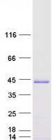 protq96jy6 pdlim2 human recombinant protein