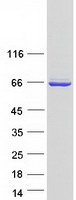 protq96kc8 dnajc1 human recombinant protein