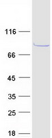 Coomassie blue staining of purified CABS1 protein