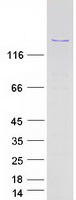 Coomassie blue staining of purified PPP1R13B protein
