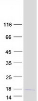 protq96kx0 lyzl4 human recombinant protein