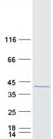 Coomassie blue staining of purified PRMT6 protein