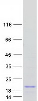 Coomassie blue staining of purified ATP6V1G3 protein