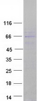 protq96li5 cno6l cnot6l human recombinant protein