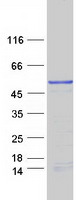 Coomassie blue staining of purified MAGEB10 protein