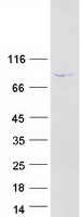 protq96mc2 drc1 human recombinant protein