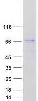 protq96me1 fbxl18 human recombinant protein
