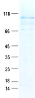 protq96mn2 nalp4 nlrp4 human recombinant protein