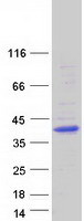 protq96mp8 kctd7 human recombinant protein