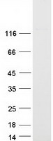 Coomassie blue staining of purified CFAP44 protein