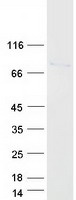 protq96n76 uroc1 human recombinant protein