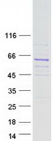 protq96nl0 rundc3b human recombinant protein