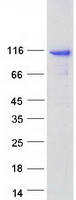 protq96p47 centg3 agap3 human recombinant protein