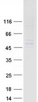 Coomassie blue staining of purified WDFY2 protein