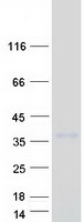 protq96pb8 lrp15 lrrc3b human recombinant protein