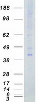 protq96pf2 tssk2 human recombinant protein