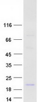 Coomassie blue staining of purified DEFB118 protein
