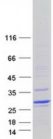 Coomassie blue staining of purified DUX5 protein