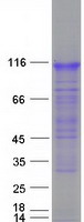 protq96px1 rnf157 human recombinant protein