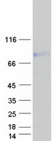 protq96px6 ccdc85a human recombinant protein