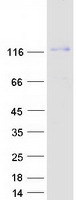 Coomassie blue staining of purified TRAPPC9 protein
