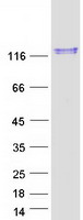 protq96ru2 usp28 human recombinant protein