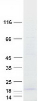 protq96s19 c16orf13 mettl26 human recombinant protein