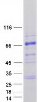 Coomassie blue staining of purified TESK2 protein