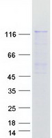 protq96sb8 smc6l1 smc6 human recombinant protein