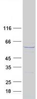 Coomassie blue staining of purified CCT8L2 protein