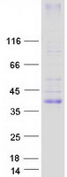 Coomassie blue staining of purified KCNK17 protein
