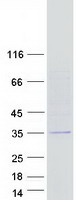 protq96t59 cdrt15 human recombinant protein